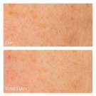 XBiotic Radiance Serum thumbnail